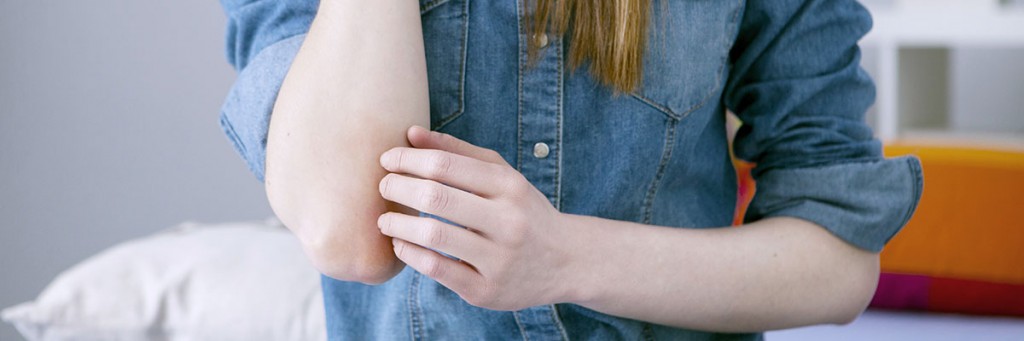 Aviso sobre el curso El reto de la Psoriasis