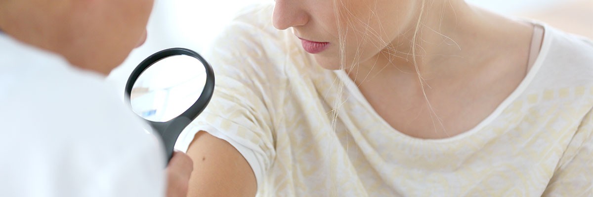 Cronificar el melanoma será posible en algunos casos