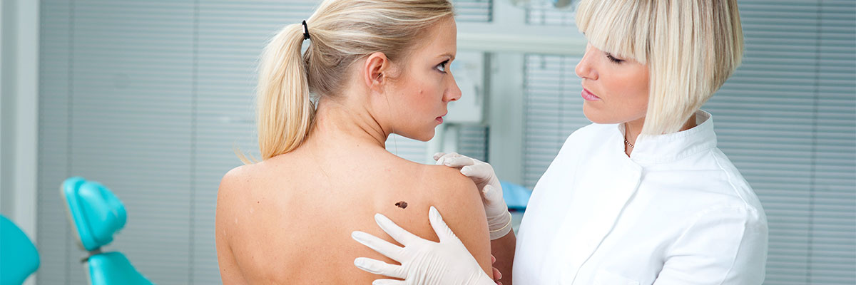 La modificación del virus del herpes labial ayuda a combatir el melanoma