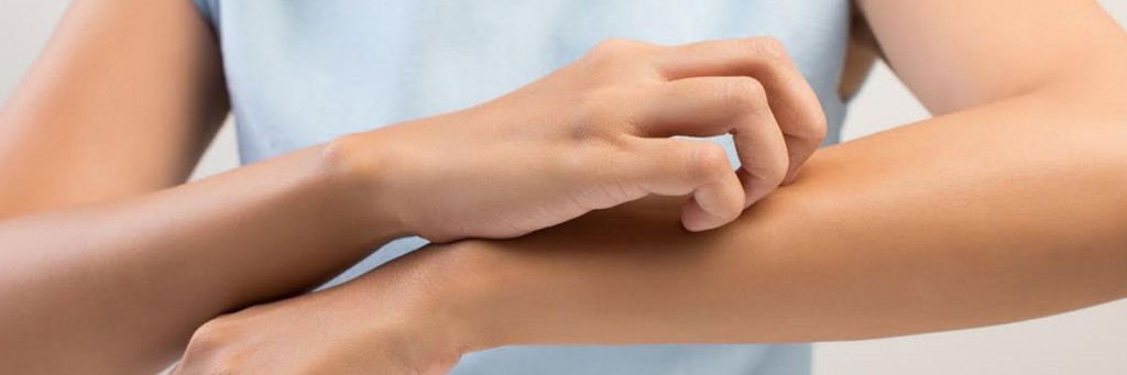 La alergia cutánea