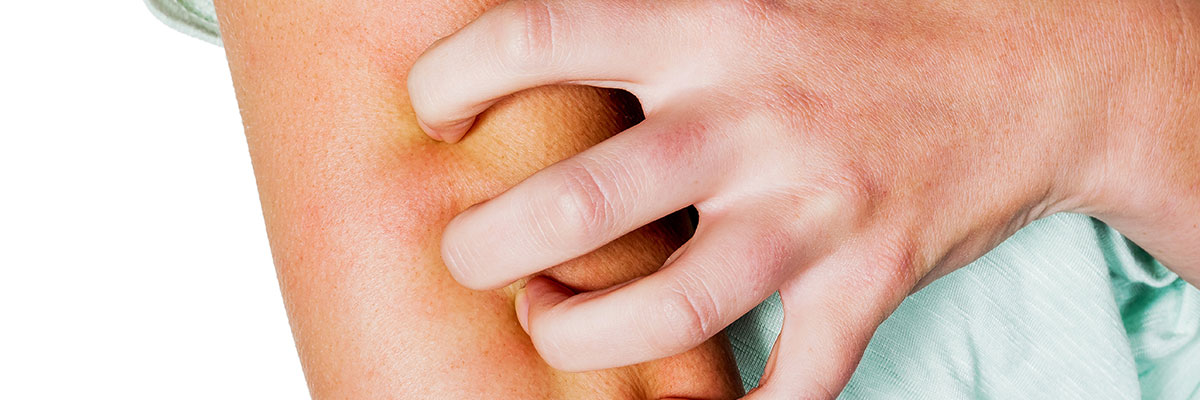 Actualización en Infecciones Cutáneas y Dermatología Tropical