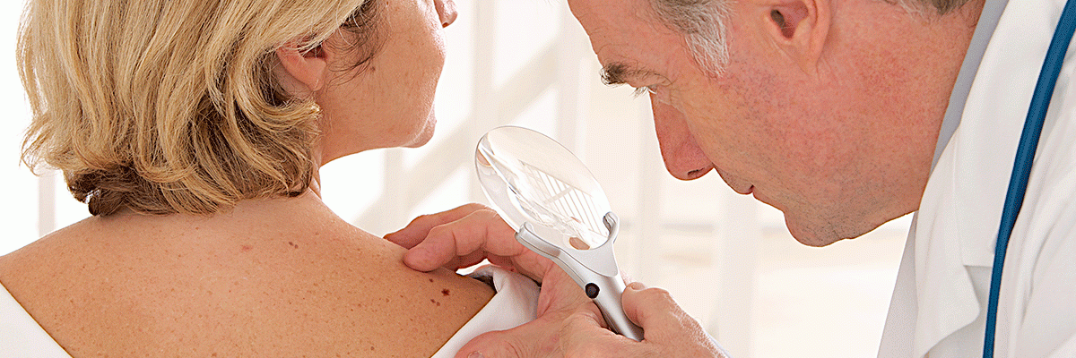 La AEDV con el Día de la Prevención del Cáncer de Piel