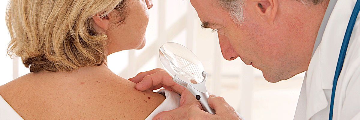 La AEDV con el Día de la Prevención del Cáncer de Piel
