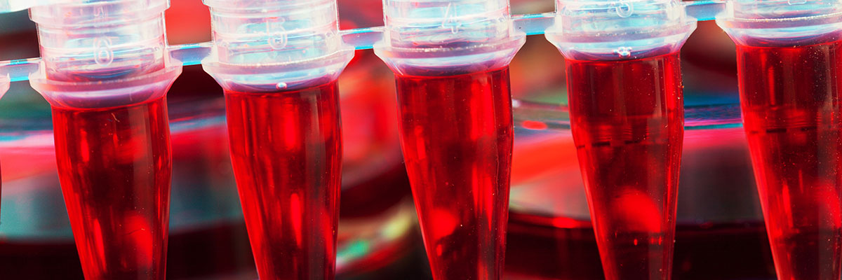 Plasma autólogo