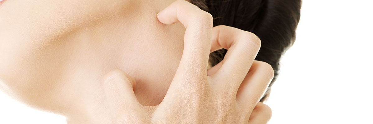 Urticaria