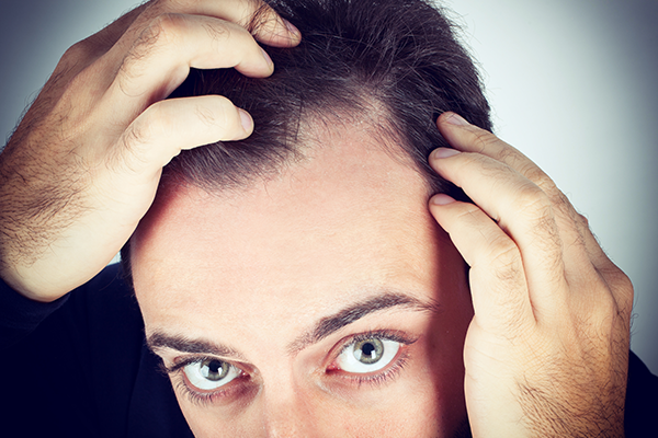 consejos caída del cabello