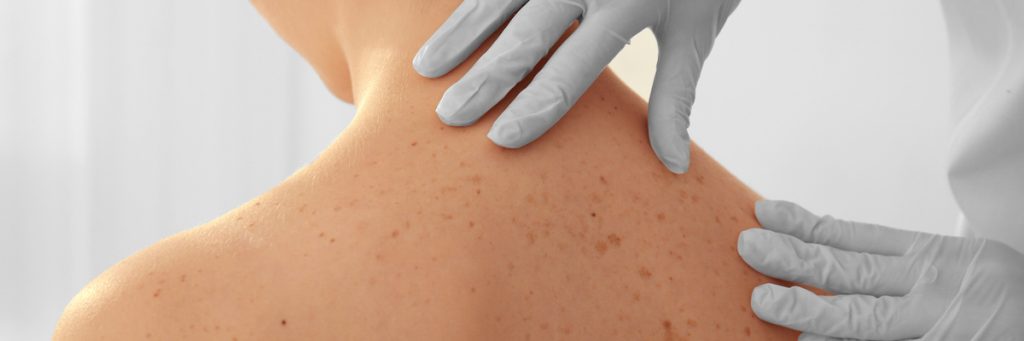 Los MIR prefieren de nuevo la Dermatología