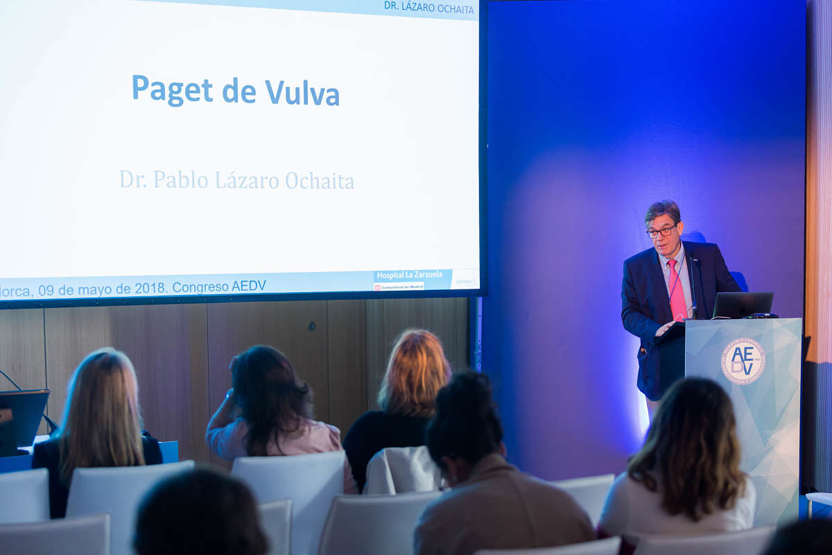 Patologia Tumoral Vulva