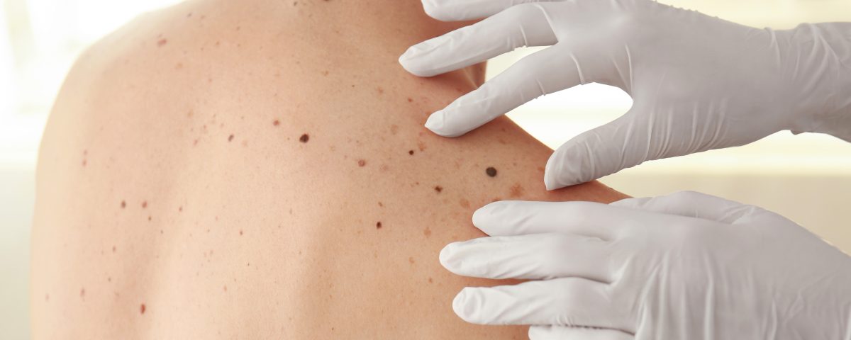 Dermatólogos no hospitalarios