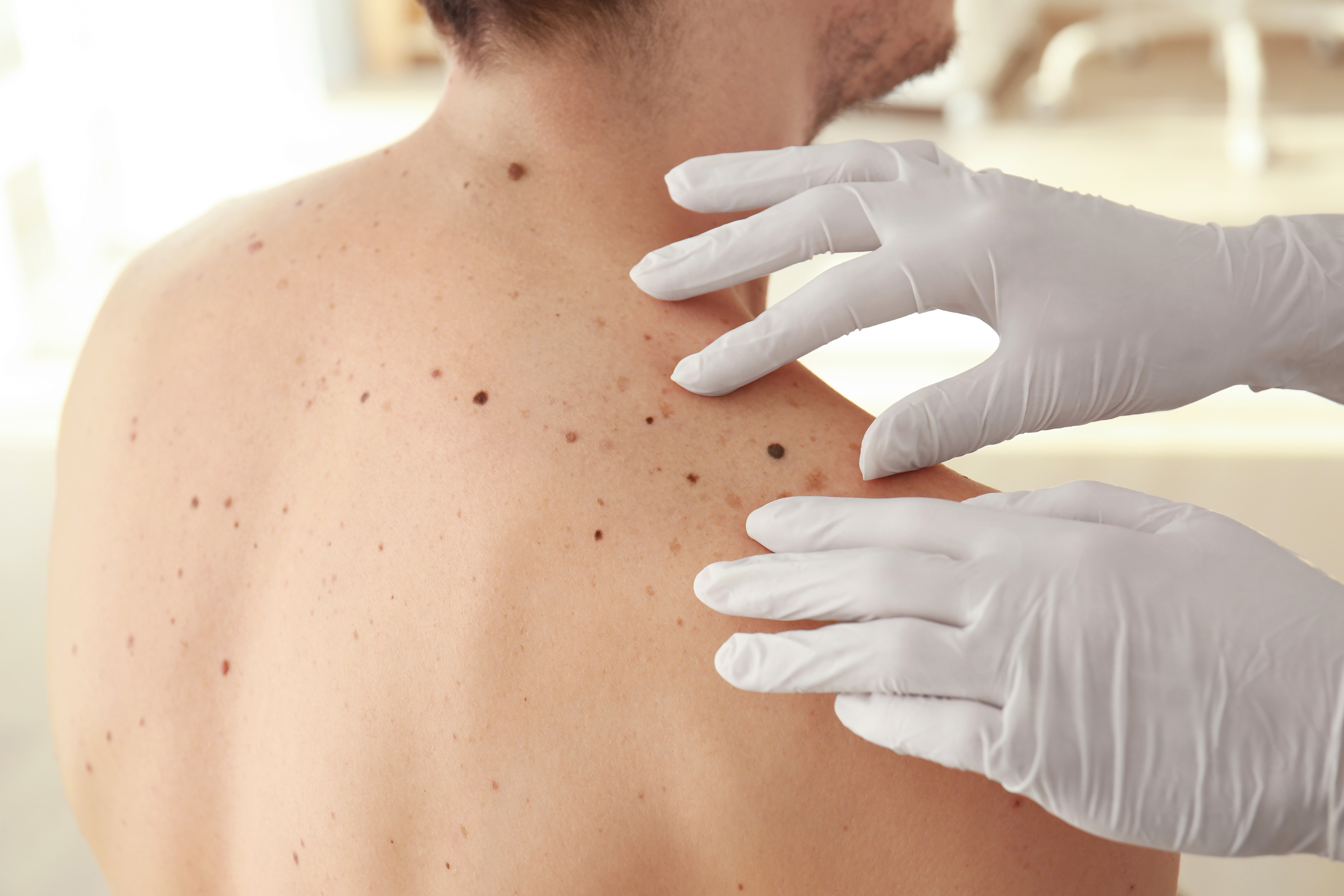 Dermatólogos no hospitalarios