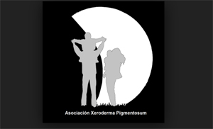 xeroderma