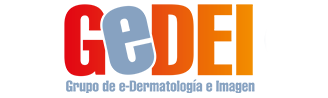 GEDEI