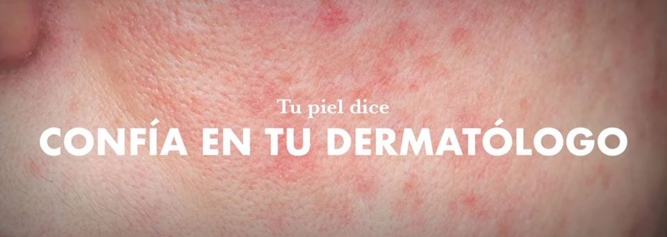 tu-piel-dice