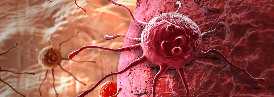 cancer-piel