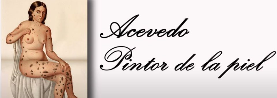 ACEVEDO