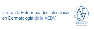 EPIDEMIOLOGÍA