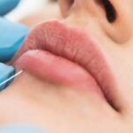 sentencia-procedimientos-esteticos